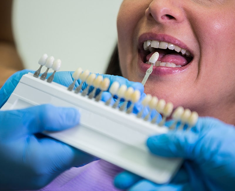 ESTETICA-DENTAL-SERVICIOS ESTETICA DENTAL - CLINICA DENTAL TETUAN