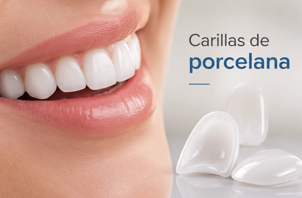CARILLAS DE PORCELANA